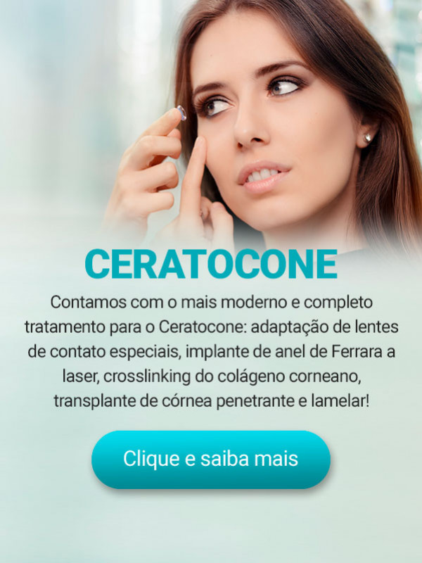 Ceretocone