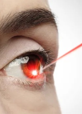Trabeculoplastia Seletiva a Laser
